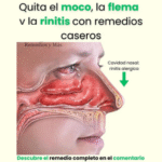 Remedios Caseros para Eliminar el Moco y la Rinitis: Guía Completa