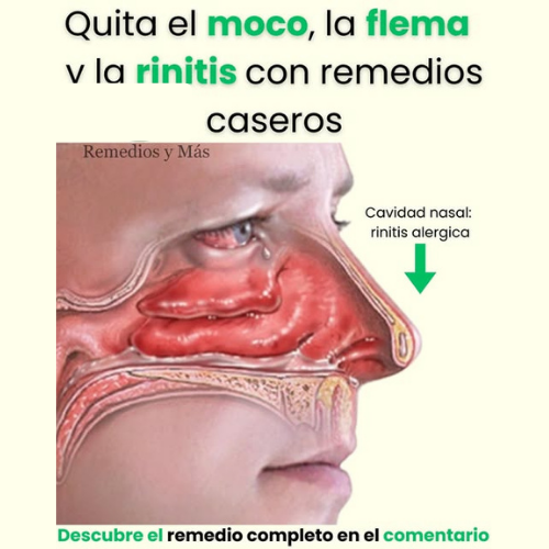 Gráfico anatómico de la cavidad nasal