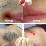 ¡Deja de Afeitarte! Descubre Cómo El Ajo Puede Transformar tu Piel y Eliminar el Vello No Deseado de Forma Natural