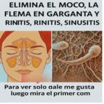 Remedios Caseros para Eliminar Moco, Flema y Rinitis