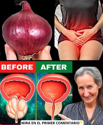 Remedios caseros con cebolla roja