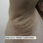 Síntomas Tempranos de Problemas de Salud y Remedios Naturales