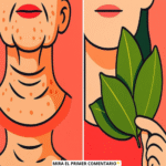 El Poder del Laurel: Un Remedio Natural Contra las Arrugas