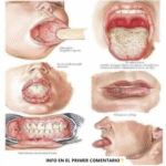 Señales de Alerta en la Salud Oral: Lo que Debes Saber