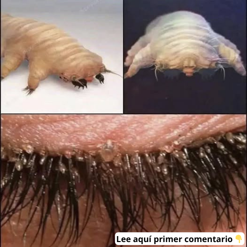 Ácaros microscópicos y tardígrados en el cuerpo humano