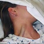 Consecuencias de Dormir con un Pañuelo en el Rostro: Salud y Bienestar