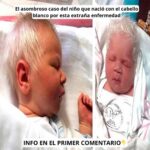 El Asombroso Caso del Niño que Nació con Cabello Blanco: Una Anomalía Genética Fascinante