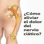 Alivio Natural del Dolor del Nervio Ciático: Estrategias Efectivas