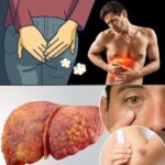 10 Señales de Alerta de que Tu Hígado Podría Estar en Problemas