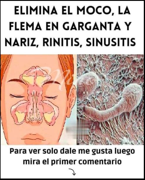 Remedios Caseros para la Congestión Nasal