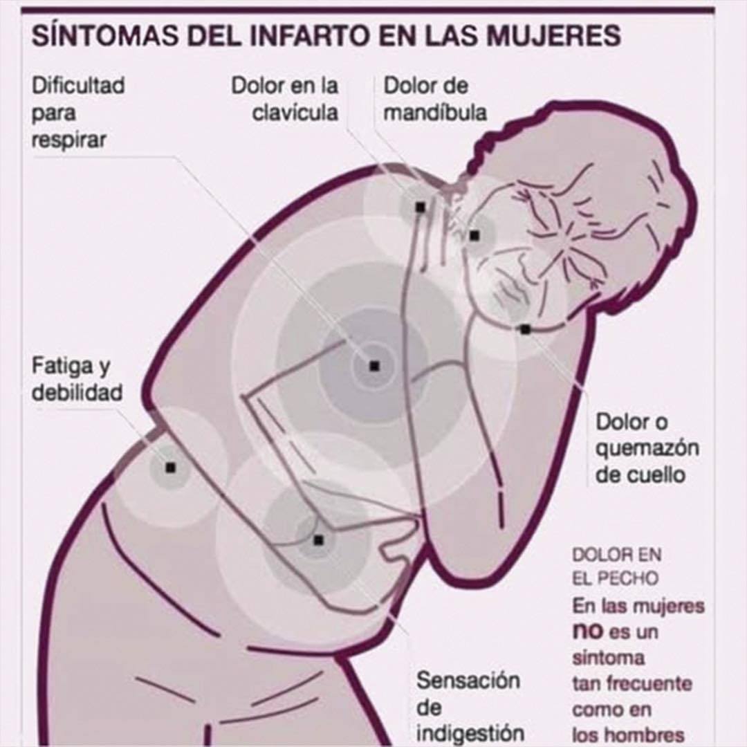 Síntomas de infarto en mujeres