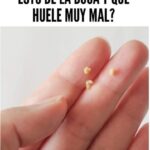 Bolitas Amarillentas en la Boca: Lo Que Debes Saber y Cómo Tratarlo