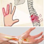 ¿Por Qué se Te Duermen las Manos? Causas y Remedios Naturales