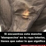 ¿Qué significa la mancha blanquecina en tu ropa interior? Todo lo que necesitas saber