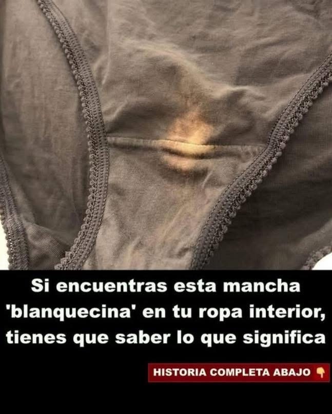 Ropa interior con mancha blanquecina