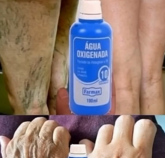 Uso de agua oxigenada en el rostro