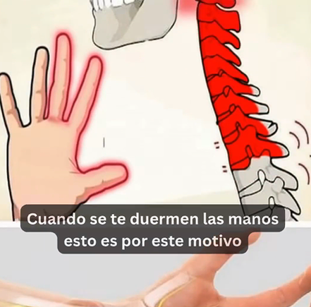 Manos adormecidas
