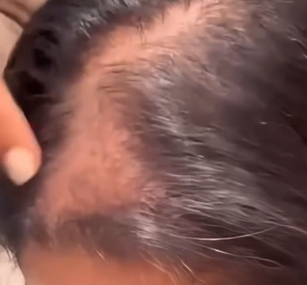 Ingredientes para hacer crecer el cabello