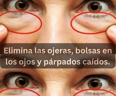 Elimina ojeras y bolsas en los ojos