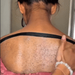 Exfoliantes Naturales: Elimina la Piel Muerta de Manera Efectiva