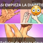 7 Señales de Azúcar Alta en la Sangre: Aprende a Reconocerlas