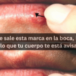 Cómo Tratar el Herpes Labial y Aftas: Remedios Naturales Efectivos