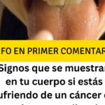 Conociendo el Cáncer de Estómago: Síntomas Silenciosos y Prevención