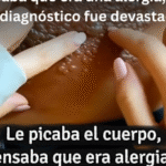 Remedios Caseros para la Culebrilla: Alivia el Dolor y Acelera la Recuperación