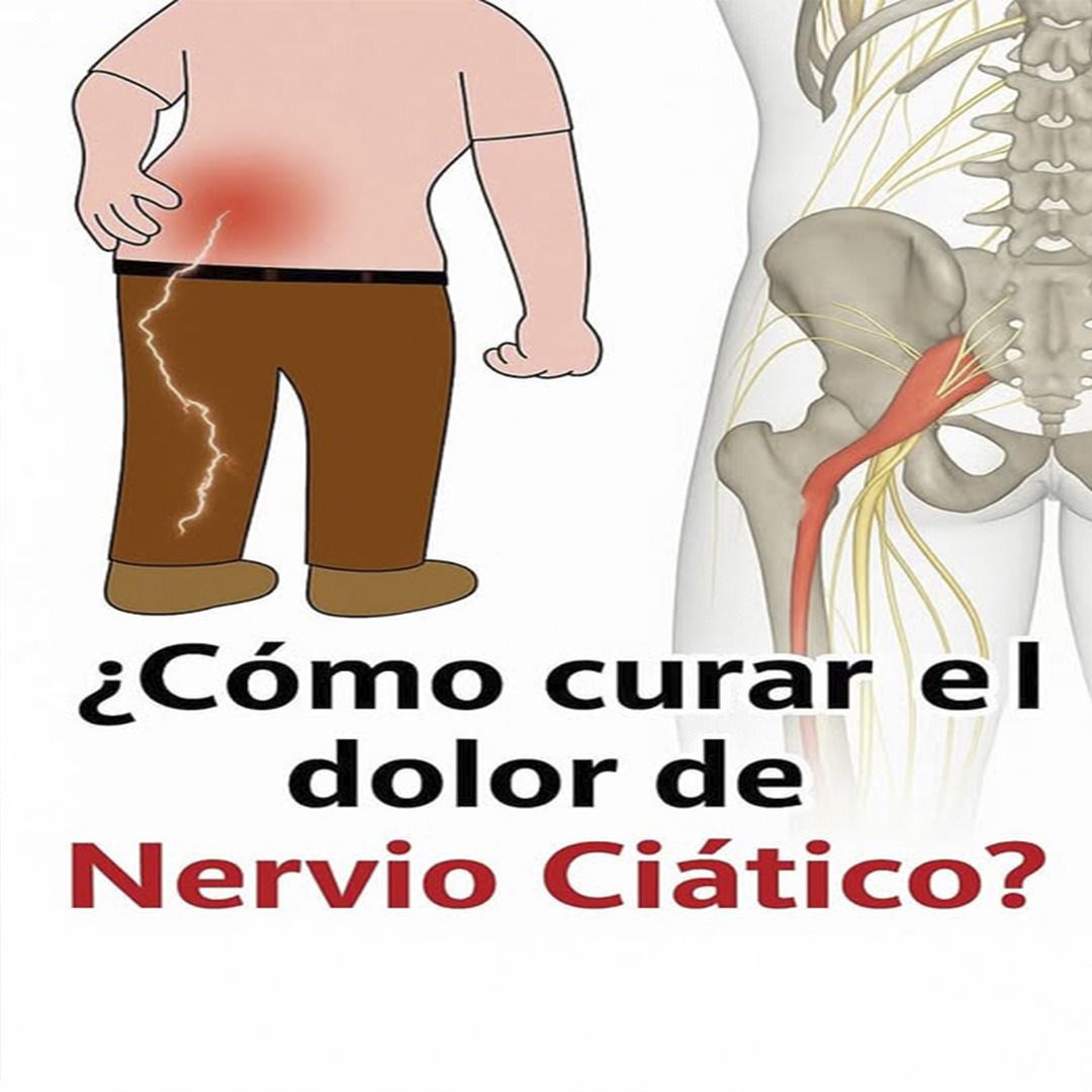 Dolor ciático