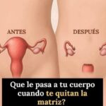 ¿Qué le pasa a tu cuerpo cuando te quitan la matriz? Descubre la verdad detrás de la histerectomía