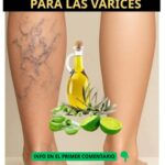 Remedio Natural para las Várices: La Cura de Mi Abuela
