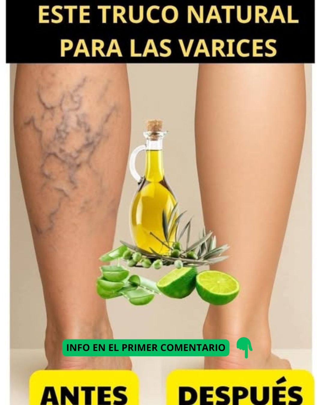 Remedio para las Várices