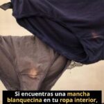 Manchas Blancas en la Ropa Interior: Qué Significan y Cómo Actuar
