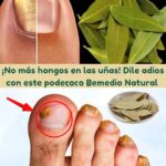 Dile Adiós a los Hongos en las Uñas con Este Poderoso Remedio Natural