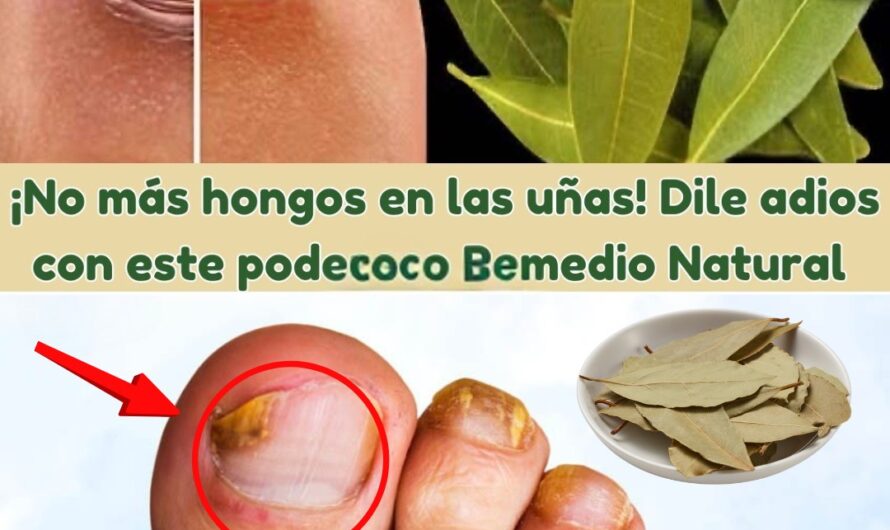 Dile Adiós a los Hongos en las Uñas con Este Poderoso Remedio Natural