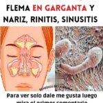 Elimina de Raíz el Moco y la Flema con Este Remedio Casero