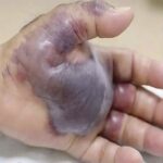 Consecuencias de Dormir con el Teléfono: Salud y Remedios Caseros