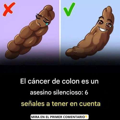 El cáncer de colon es un asesino silencioso
