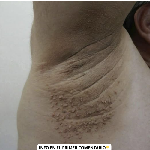 Remedios naturales para el estrés