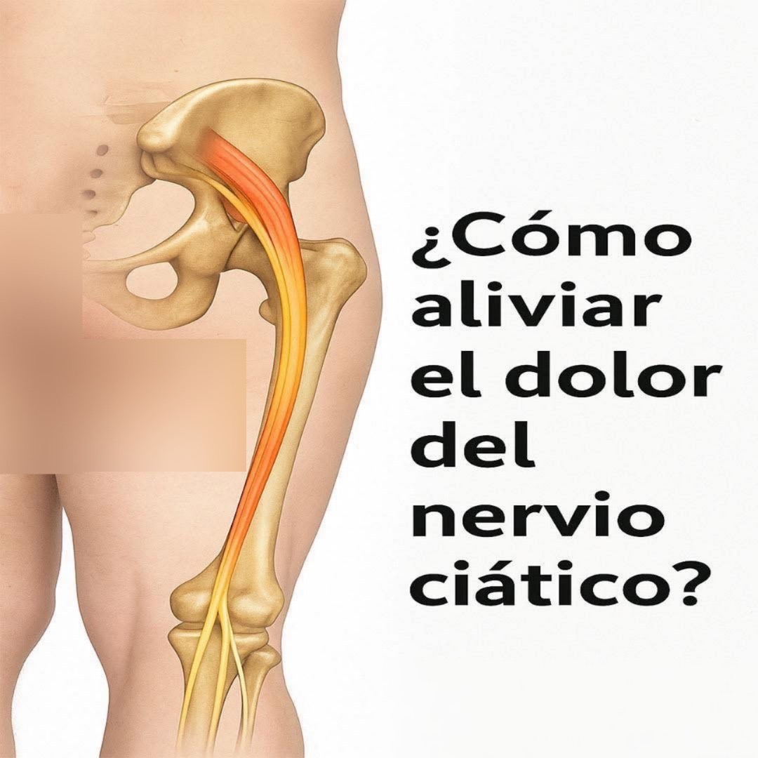 Dolor ciático