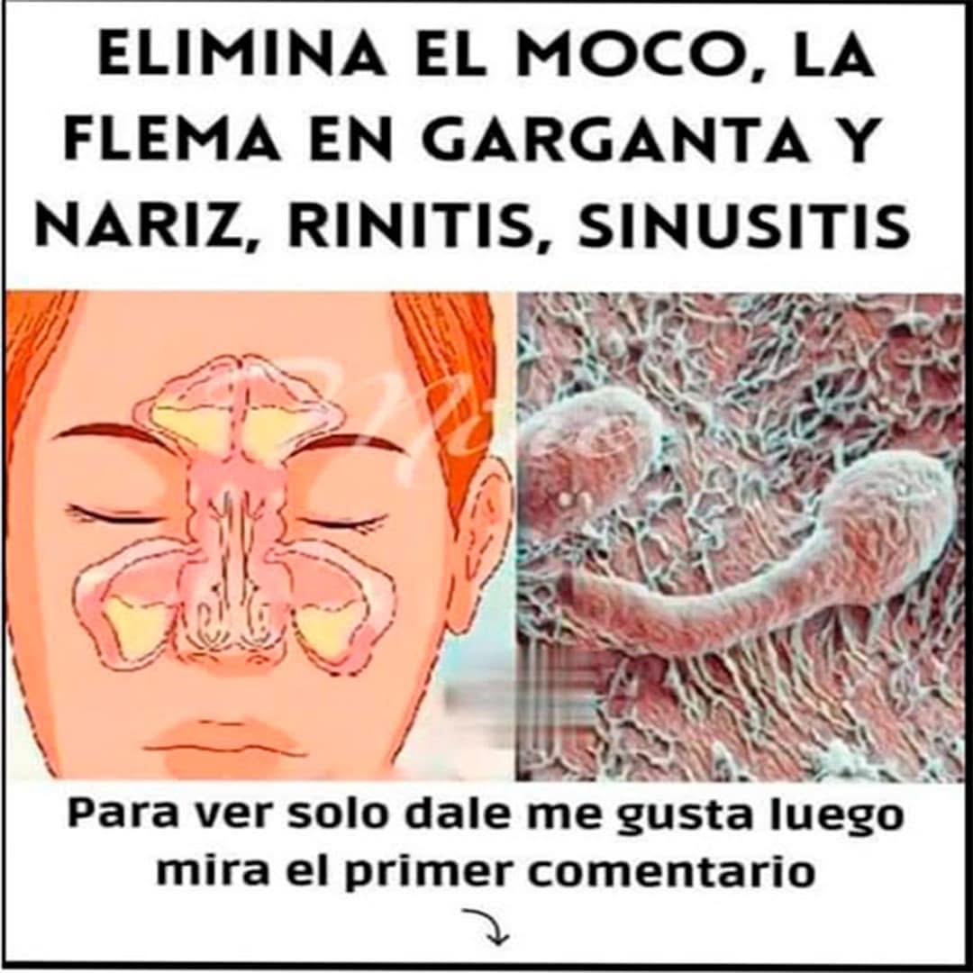 Eliminación de moco y flema