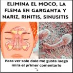 Elimina el Moco y la Flema: Remedios Caseros y Naturales