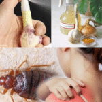 Remedios Naturales para Deshacerte de las Chinches en tus Sábanas