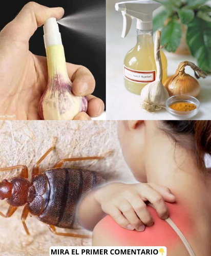 Remedios naturales para chinches