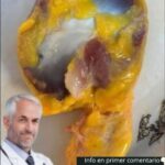 Los Beneficios de la Molleja de Pollo: Recetas Saludables y Consejos