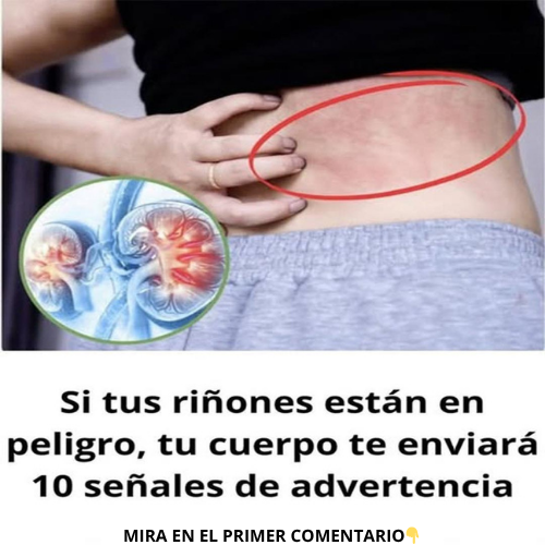 Señales de advertencia de problemas renales