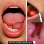 Remedios Naturales para Mejorar la Salud: Recetas Efectivas y Caseras