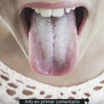 La Salud de Tu Lengua: ¿Qué Indica el Color Blanco y Cómo Mejorar Tu Bienestar?