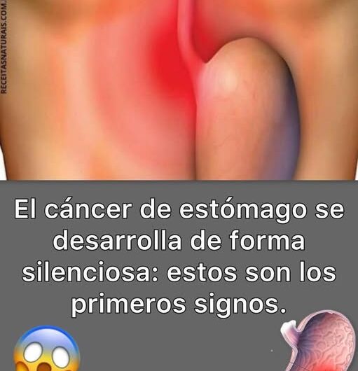 Signos Tempranos del Cáncer de Estómago: Identifícalos y Cuida tu Salud