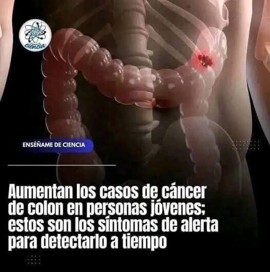 Cómo Detectar a Tiempo los Síntomas del Cáncer de Colon en Jóvenes